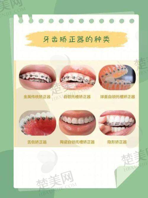 二、昆明奥格口腔——价格合理且能提前预见成效的医院