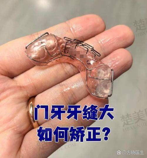 六、云南省第一人民医院（昆华医院）口腔科——技术不错，价格合理的老牌医院