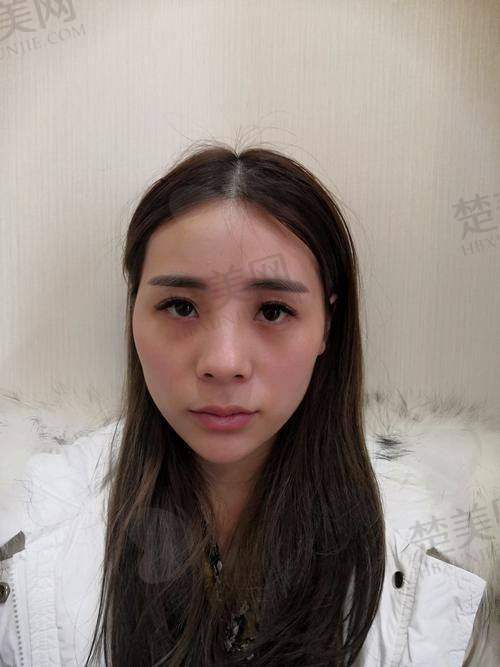 七、修复期间的注意事项