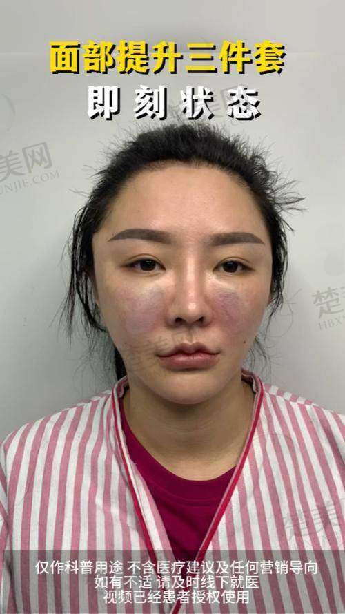 七、总结张明兴医生做的AMAS提升成效评价