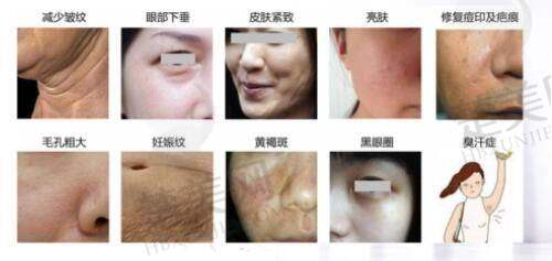 三、榆林瑞美瑞亚医疗美容门诊部诊疗项目有哪些？
