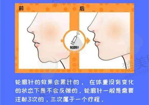 四、重庆时光整形美容医院
