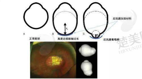 二、大连华厦眼科医院地址在哪里啊之医院科室及技术