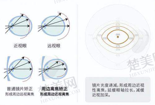 二、菏泽及周边可开展飞秒手术的国有医院