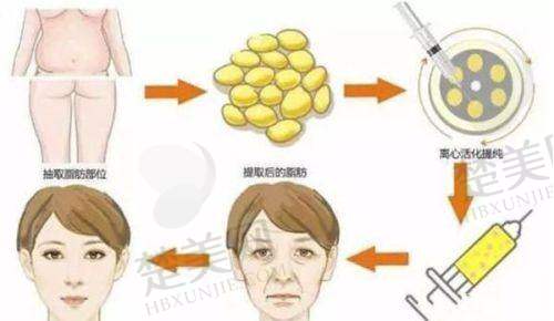 七、深圳依美医疗美容门诊部地址及交通