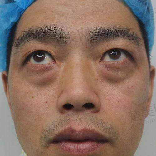 一、北京李燕医生个人实力大揭秘