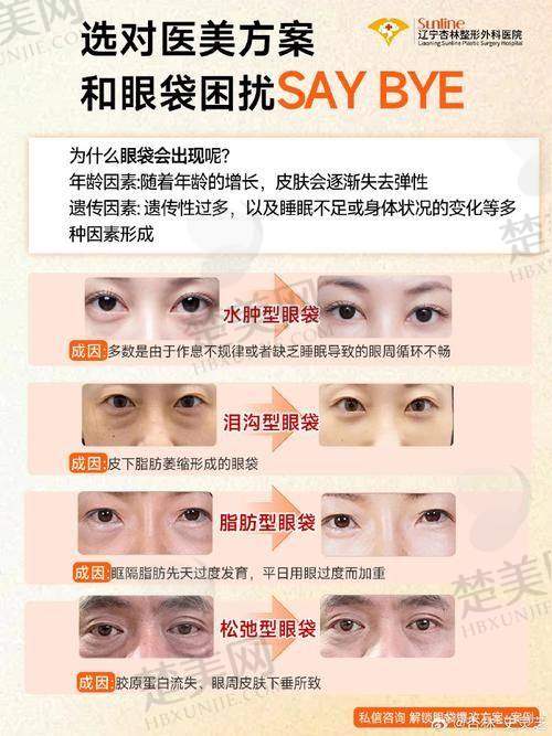 五、北京李燕医生患者反馈：口碑见证实力