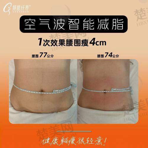 一、北京微美汇医疗美容诊所——专精大腿吸脂之选