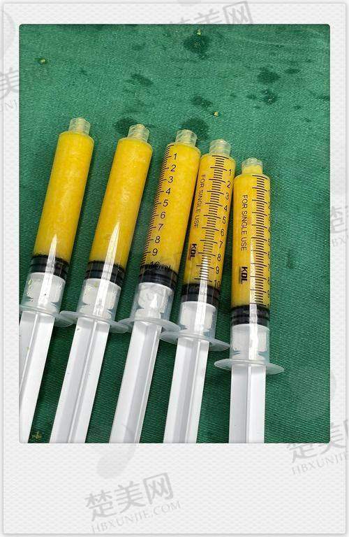九、北京金圣医疗美容诊所——满足多样需求的大腿吸脂诊所