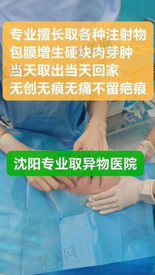 二、注射填充物取出之个性化方案选择关键因素