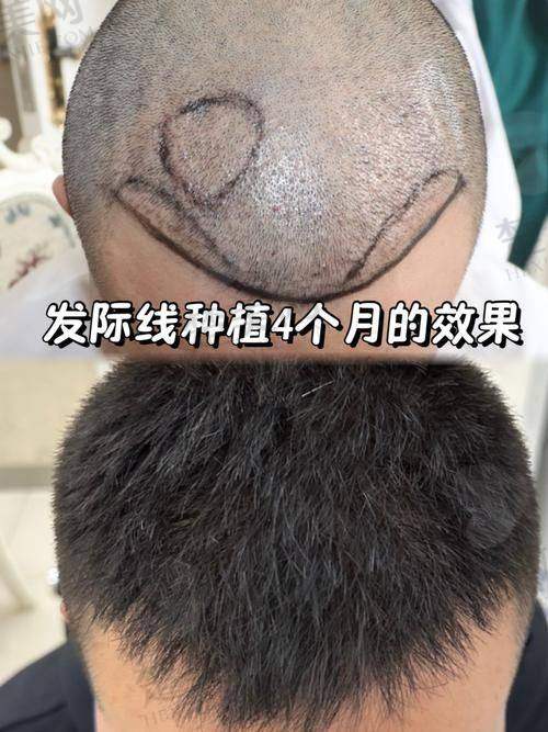 一、成都国有医院推荐