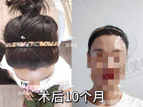 三、选择植发医院的逻辑建议