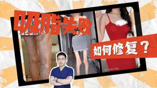 三、王东医生擅长的修复手术项目