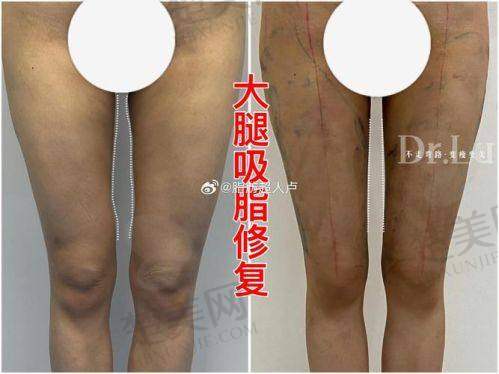 五、顾客对王东医生修复手术的真实评价