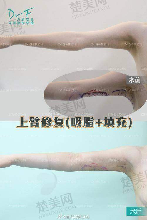 六、如何预约王东医生