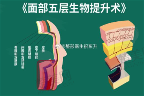 五、如何选择适合自己的筋膜提升医院和医生