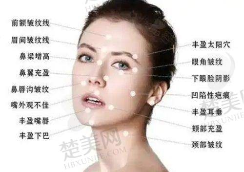 一、张越越简介