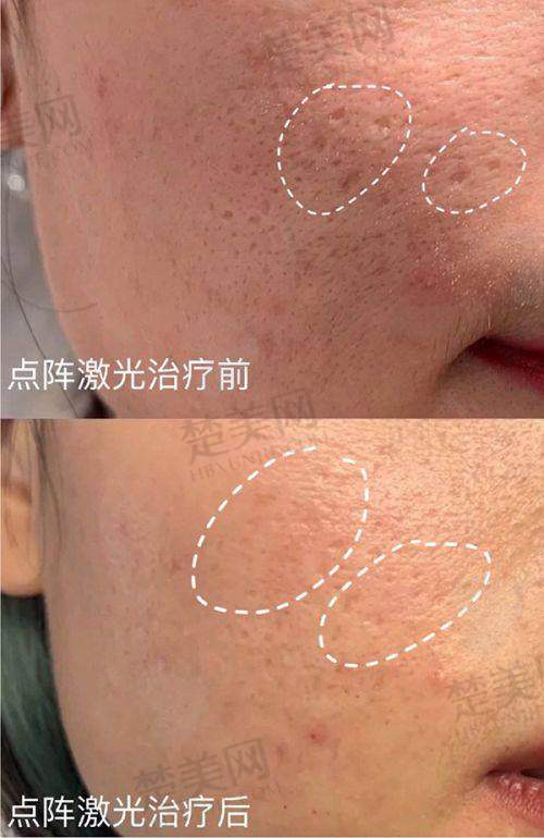 十、珠海九龙植发科：专注植发改善头发健康