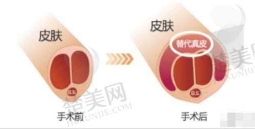 六、成都东篱整形