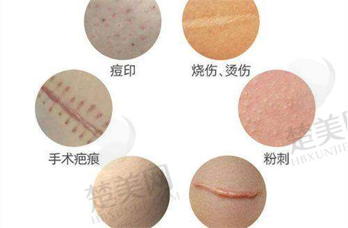 三、南宁东方整形医院——隆胸修复骨干医生