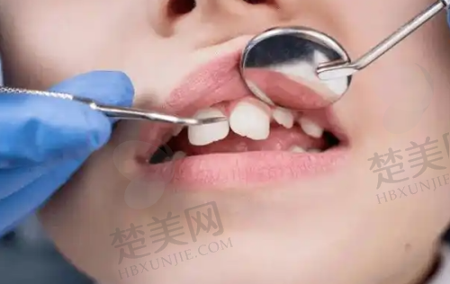 八、肇庆中大口腔医院预约方式