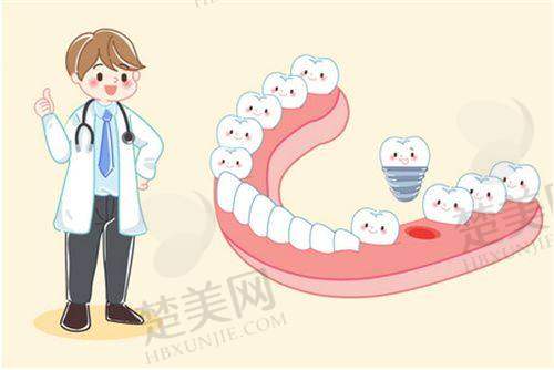 六、浙江口腔医院：数字种植，负重领跑
