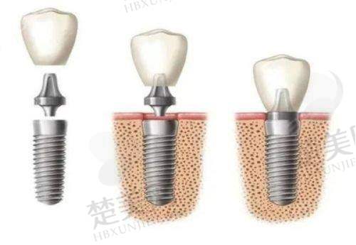 二、上海美乐口腔医院靠谱吗