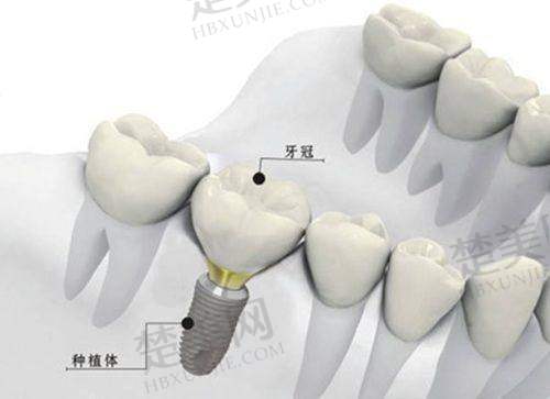 九、舒适体验的口腔诊所——巴彦淖尔何宝珠口腔
