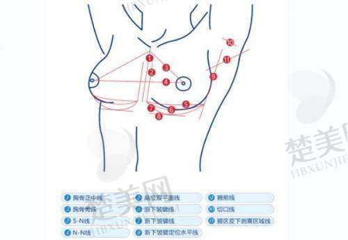 七、珠海欣悦医疗美容：高品质服务的保护
