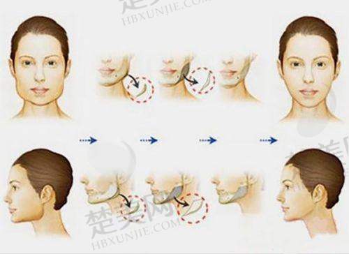 三、梅州半岛医疗美容门诊部诊疗项目有哪些？