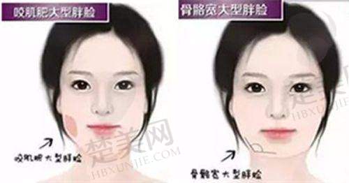三、珠海韩妃医疗美容：专注韩国整形风格