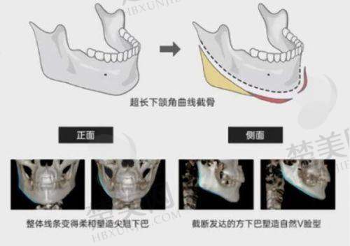 八、南宁韩成（韩国）故事医疗整形美容医院——鼻综合隆鼻骨干医生