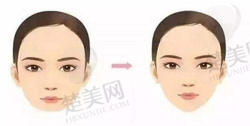 五、珠海雅媛美容：打造自然精致之美