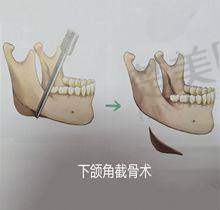 三、排名第三：保定蓝山医疗美容医院