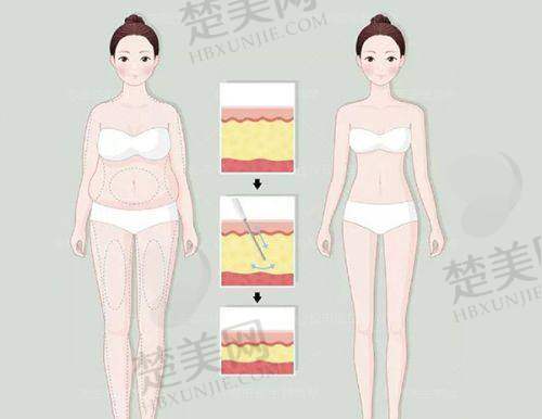 五、北京蕾士悦容整形口碑评价