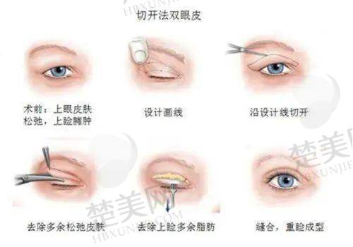 一、南宁华美整形医院——眼部修复实力派