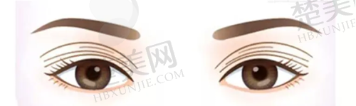 八、成都蜀尚蓉雅整形美容门诊部：眼部整形的佼佼者