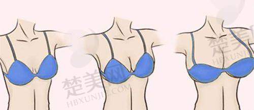 一、南京康美美容医院——舒适诊疗与专精技术并存