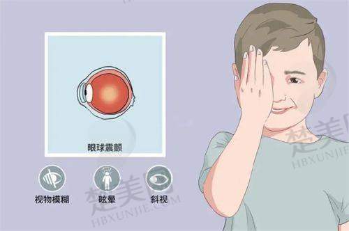 四、广州雷诺眼科诊所特色项目