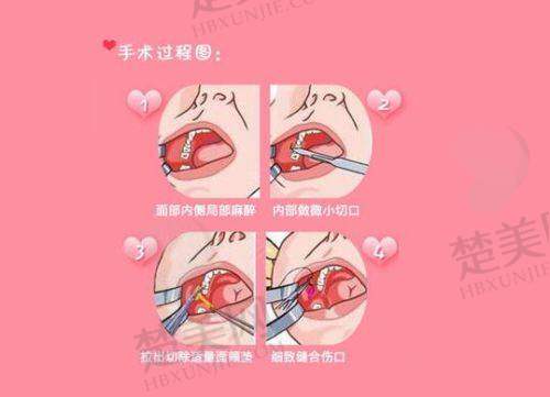 五、排名第五：保定悦美医疗美容医院