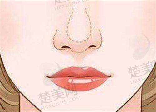 一、沈阳杏林眼部整形医院价格情况