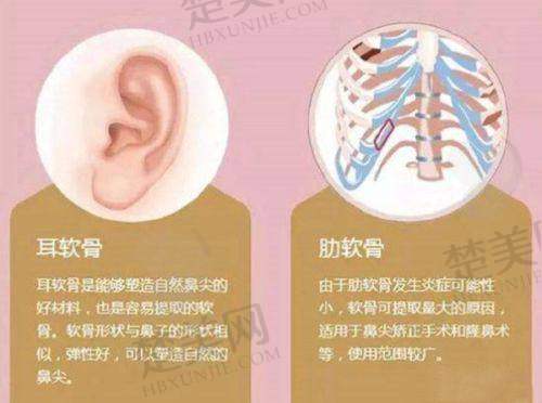五、沈阳杏林吸脂整形医院价格水平