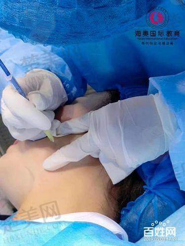 二、日常按摩去除抬头纹