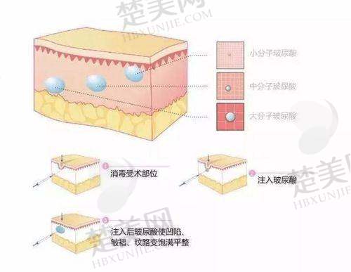 六、张越越怎么预约？