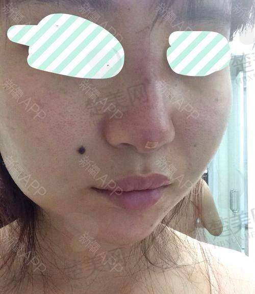 二、不同填充方式的多维度对比