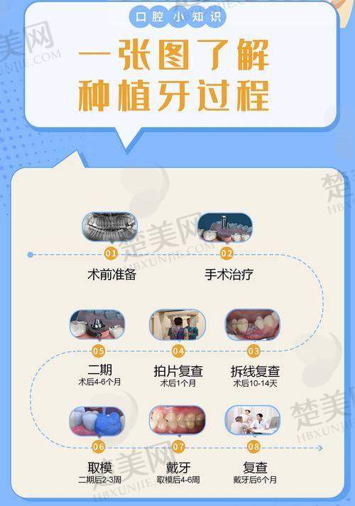 三、种植牙相关项目价格