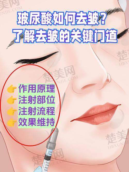 二、美容填充玻尿酸的原理
