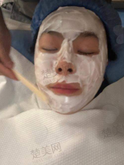 七、美容填充玻尿酸的价格情况
