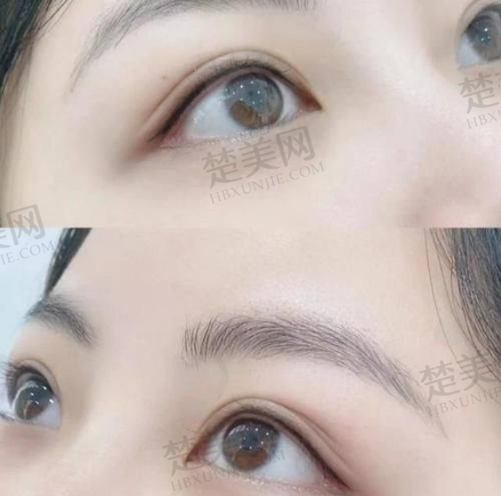 四、韩国原辰整形医院:全科整形的数字化先锋