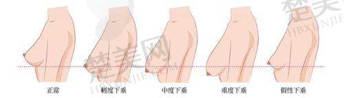 （二）艺星整形美容医院是国有还是私立？